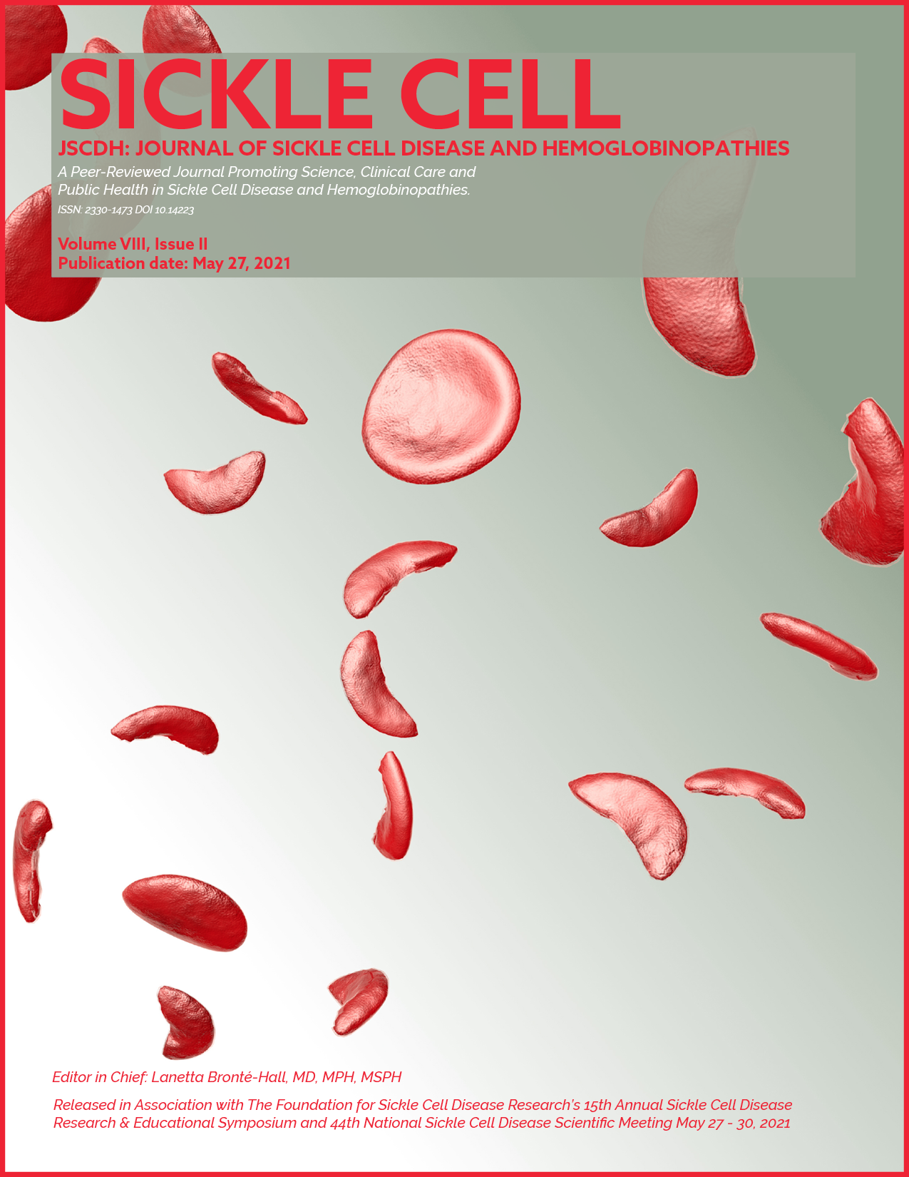 sickle cell disease research article
